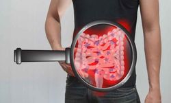 Erdoğan'ın hastalığı Gastroenterit enfeksiyon nedir? Belirtileri nelerdir?