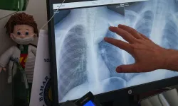 İzmir'de 8 yaşındaki çocuğun göğüs boşluğundan çıkan kitle doktorları şoke etti