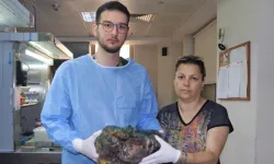 İzmir'de tıp dünyasını karıştıran olay: Karın ağrısı şikayetiyle gitti, 10 kiloluk dev tümor çıkarıldı