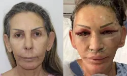 Petek Dinçöz'ün annesi estetik oldu: Son haline inanamayacaksınız