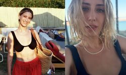 Hazal Kaya’nın yüzündeki değişim merak uyandırdı