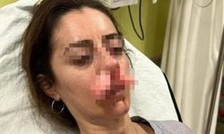 Otomobil kapısı silah sayıldı: Eşinin sevgilisine benzetti, saldırdı