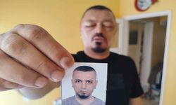 Saçlarını siyahlatmak için aldığı şampuan hayatını kabusa çevirdi