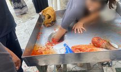 Salça makinesine elin kaptırdı: Genç kızı itfaiye kurtardı