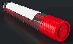 Satürasyon nedir? Nasıl ölçülür ve normal değerleri kaç olmalı?