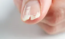 Kırılgan tırnaklara veda: İşte evde uygulanabilecek doğal yöntemler