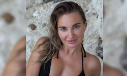 Ünlü sosyal medya fenomeninden acı haber: Estetik ameliyatı sonu oldu