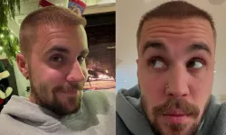 Sosyal medya bunu konuşuyor:  Justin Bieber Türkiye'de saç mı ektirdi?