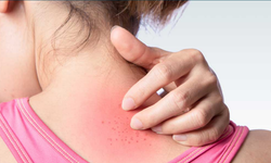 İzmir Algoloji doktorları nerededir? Algoloji muayene randevusu nasıl alınır?