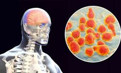 İngiltere’de menenjit alarmı: Son durum ne?