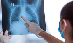 Halk sağlığı alarmı: Veremle savaş dispanserleri azalıyor!