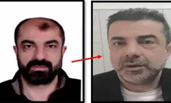 Ameliyat ile yüzünü değiştiren firari cinayet zanlısı 7 yıl sonr yakalandı