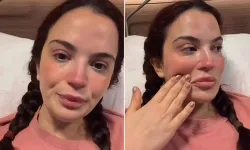 6 ameliyat geçiren Aslı Bekiroğlu'ndan duygusal paylaşım:  Terminatöre dönüşeceğim