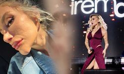 İrem Derici'den 'çene dolgusu' iddialarına yanıt