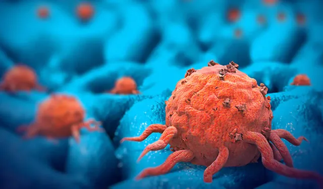 Yumurtalık kanseri tedavisinde yeni gelişme: Hücrelere zarar vermiyor