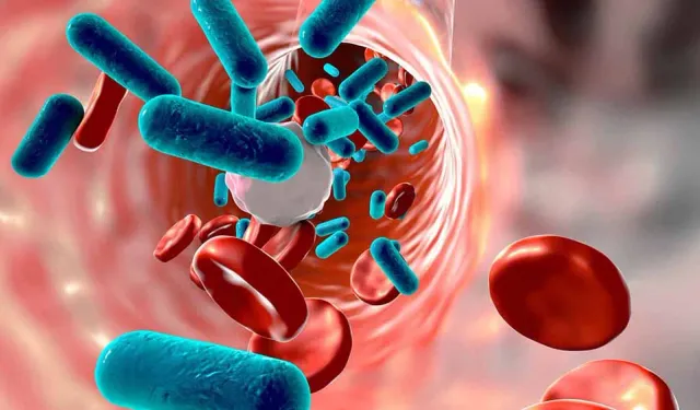 Hızlı ve sinsi: Sepsis nedir? Sepsisin belirtileri nelerdir?