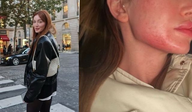 Danla Bilic eski sevgilisi Berk Çetin tarafından darp edildi: O anlar kamerada