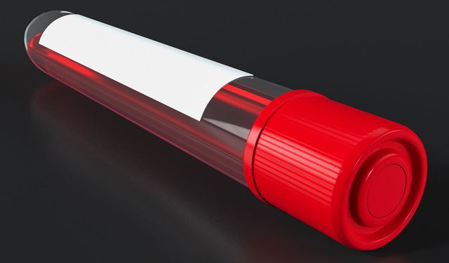 Satürasyon nedir? Nasıl ölçülür ve normal değerleri kaç olmalı?