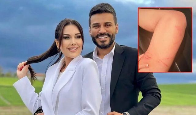 Darp izlerini paylaşıp sildi... Polat çiftinde yeni kriz: Boşanacaksın oğlum benden!