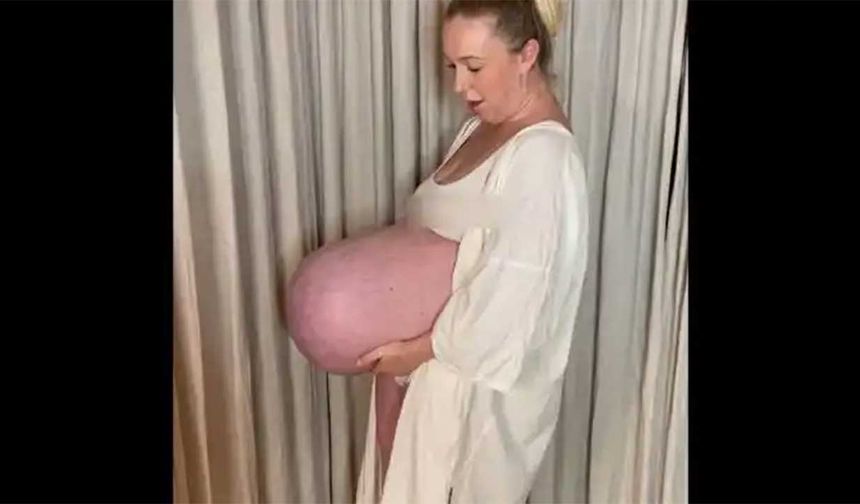 Üçüzlere hamile kadının göbeğini gören şoke oldu!