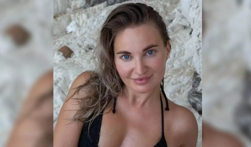 Ünlü sosyal medya fenomeninden acı haber: Estetik ameliyatı sonu oldu