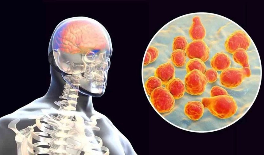 İngiltere’de menenjit alarmı: Son durum ne?