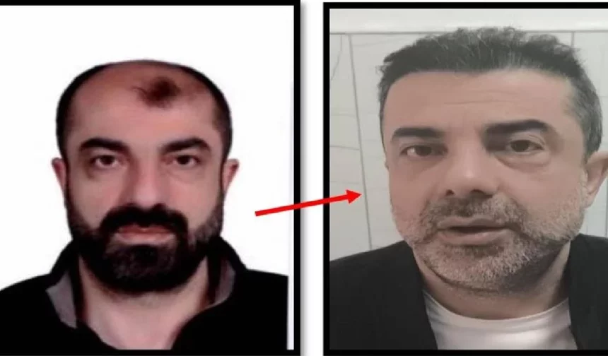 Ameliyat ile yüzünü değiştiren firari cinayet zanlısı 7 yıl sonr yakalandı