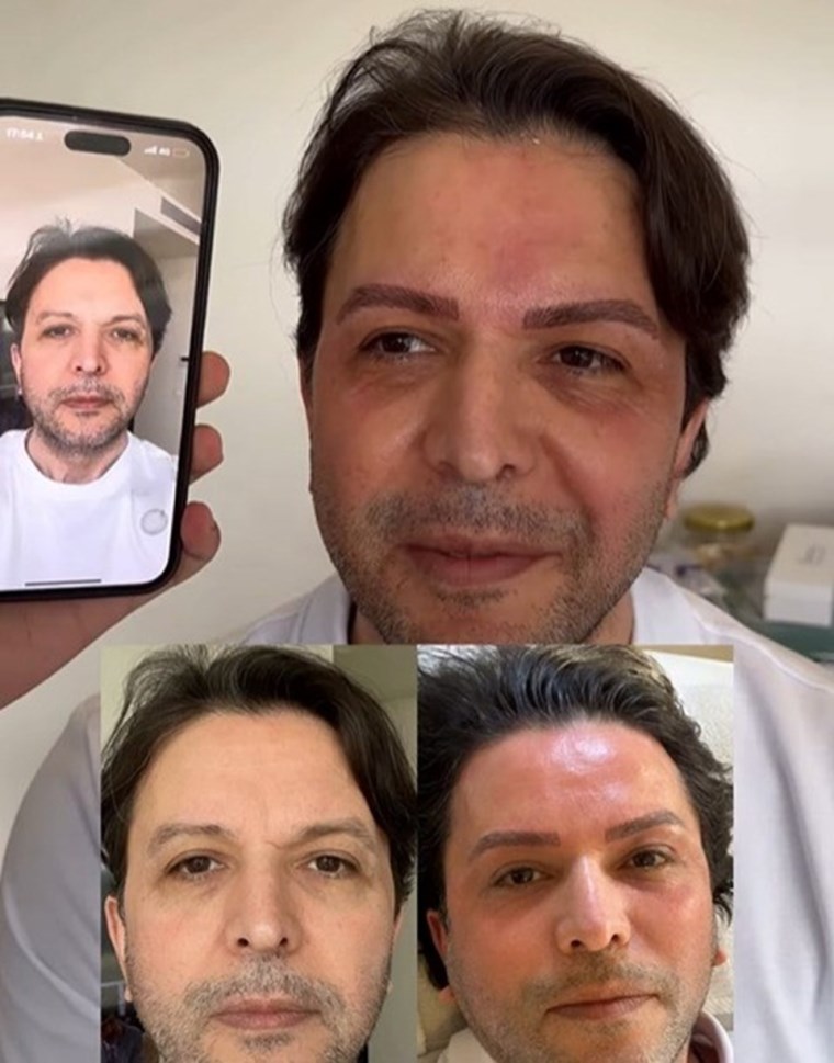 Nihat Doğan Estetik Yaptırdı Sosyal Medyada Gündem Oldu! (1)