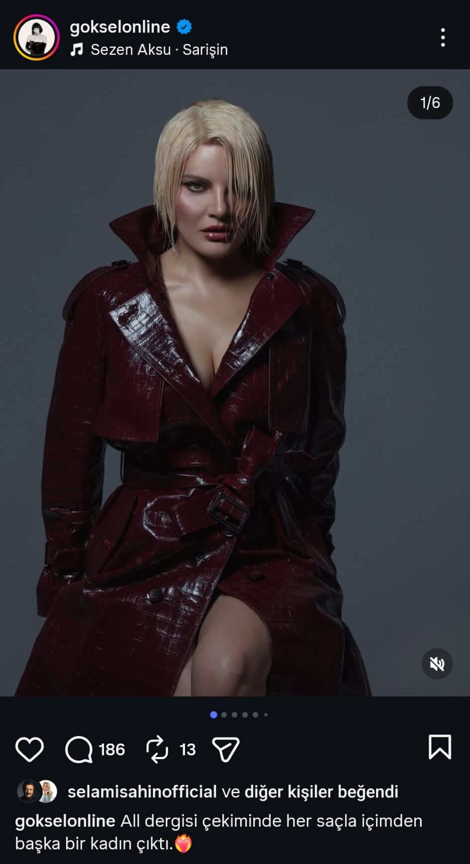 Sosyal medyada gündem oldu: Göksel'i gören tanıyamadı!