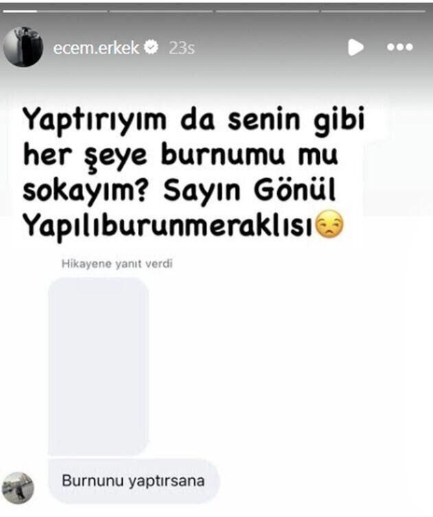 Ecem Erkek’ten estetik yorumuna sert yanıt: Senin gibi her şeye burnumu mu sokayım?
