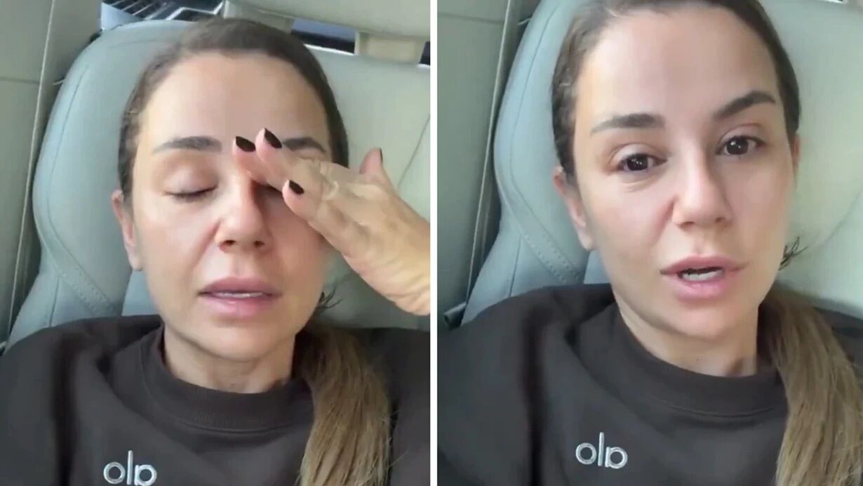 Merve Özbey sahnede merdivenden düştü: Sağlık durumunu paylaştı